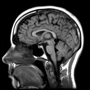 _xray-like image of the human head from profile view_